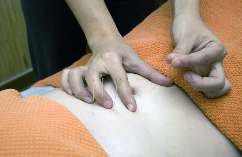 Acupuncture : ses bienfaits durant une grossesse