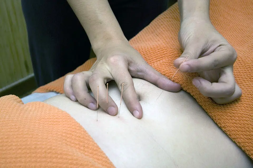 Acupuncture : ses bienfaits durant une grossesse